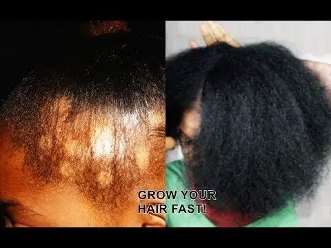 Trendy Hair Growth Oil Serum